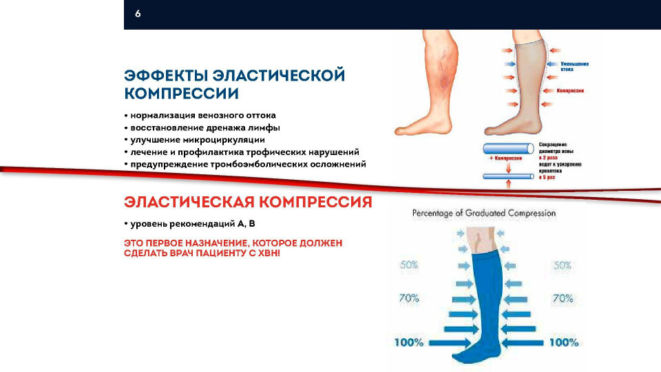 Компрессионный трикотаж презентация